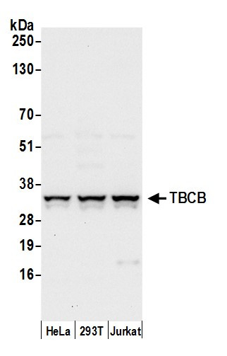TBCB Antibody in Western Blot (WB)