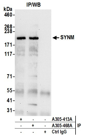 SYNM Antibody in Immunoprecipitation (IP)