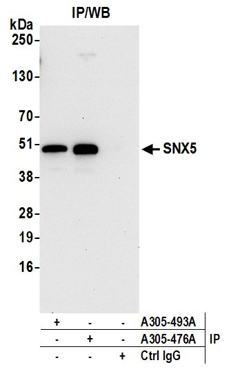 SNX5 Antibody in Immunoprecipitation (IP)