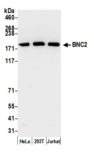 BNC2 Antibody in Western Blot (WB)
