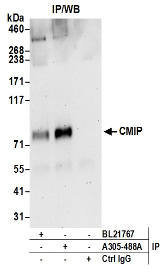 CMIP Antibody in Immunoprecipitation (IP)