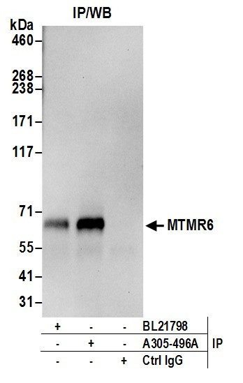 MTMR6 Antibody in Immunoprecipitation (IP)
