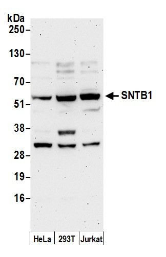 SNTB1 Antibody in Western Blot (WB)