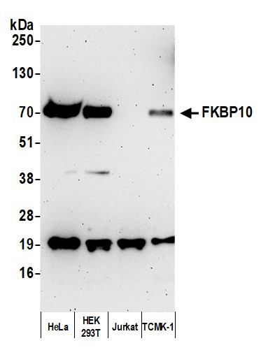 FKBP10 Antibody in Western Blot (WB)