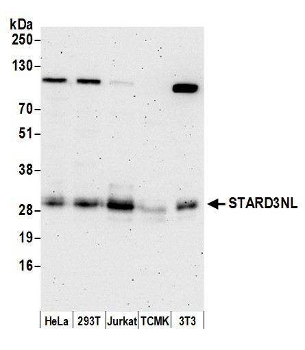 STARD3NL Antibody in Western Blot (WB)