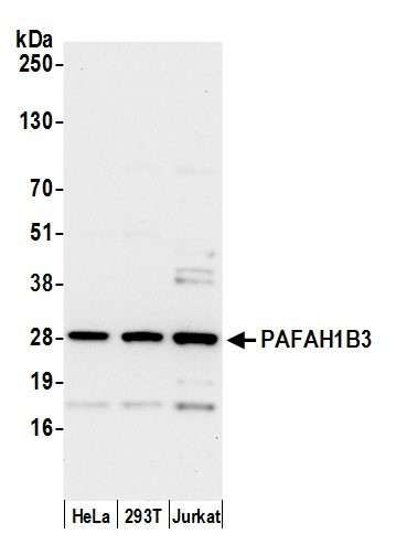 PAFAH1B3 Antibody in Western Blot (WB)