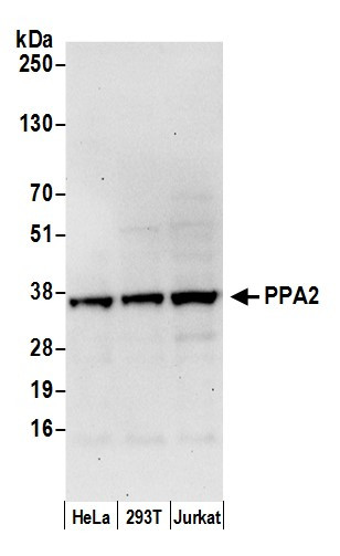 PPA2 Antibody in Western Blot (WB)