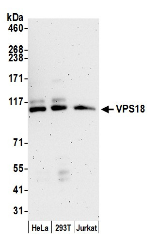 VPS18 Antibody in Western Blot (WB)