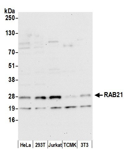 RAB21 Antibody in Western Blot (WB)