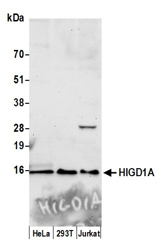 HIGD1A Antibody in Western Blot (WB)