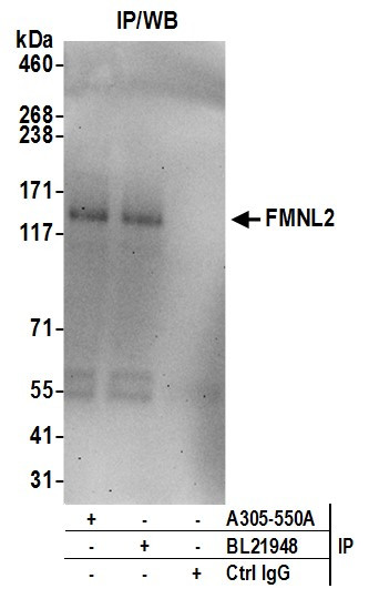 FMNL2 Antibody in Immunoprecipitation (IP)