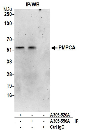 PMPCA Antibody in Immunoprecipitation (IP)