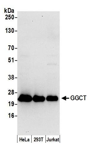 GGCT Antibody in Western Blot (WB)