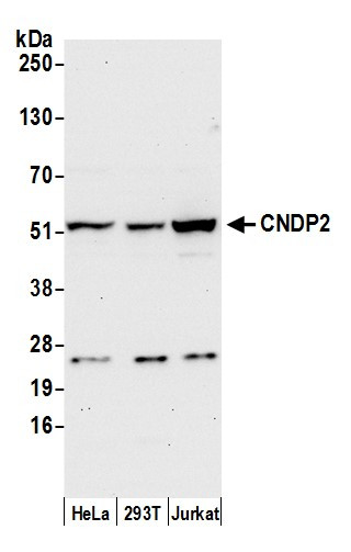 CNDP2 Antibody in Western Blot (WB)