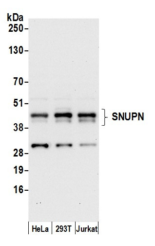 SNUPN Antibody in Western Blot (WB)