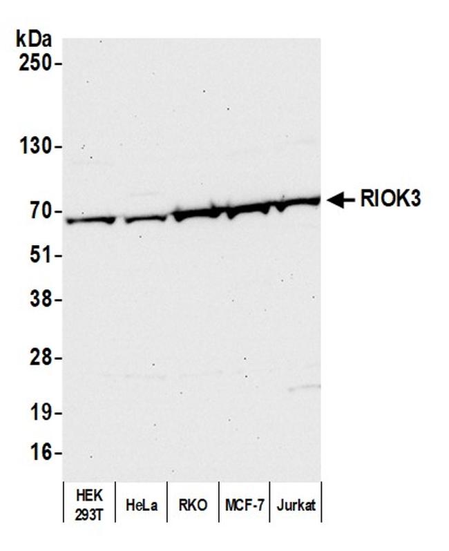 RIOK3 Antibody in Western Blot (WB)