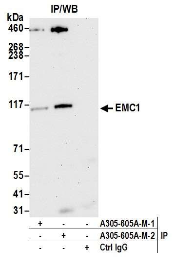 EMC1 Polyclonal Antibody (A305-605A-T)
