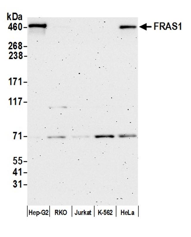 FRAS1 Antibody in Western Blot (WB)