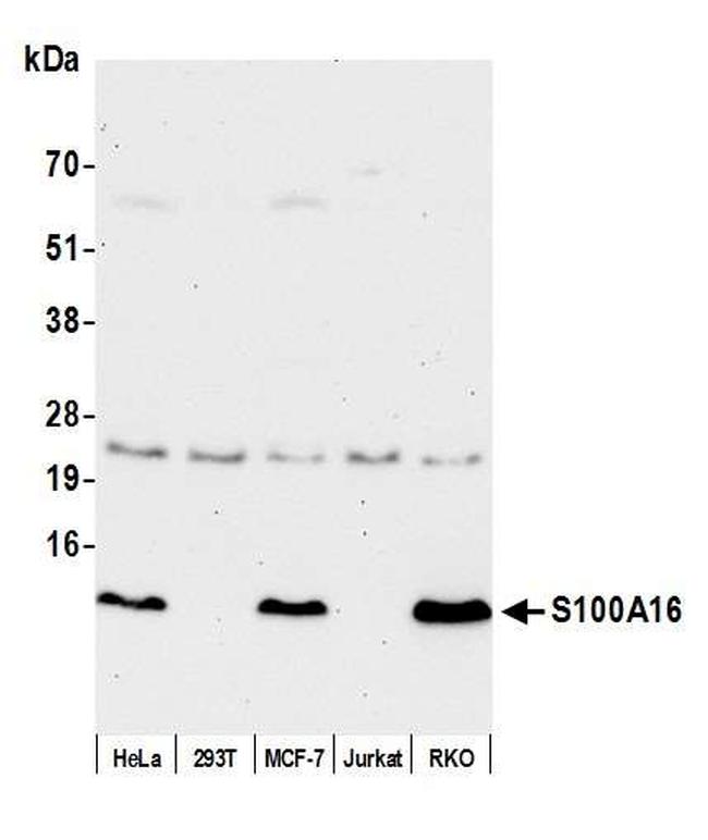 S100A16 Antibody in Western Blot (WB)