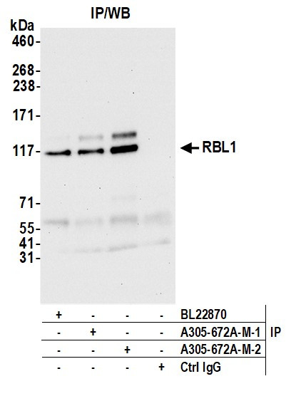 RBL1 Antibody in Immunoprecipitation (IP)