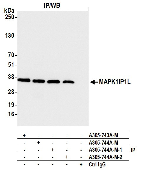 MAPK1IP1L Antibody in Immunoprecipitation (IP)