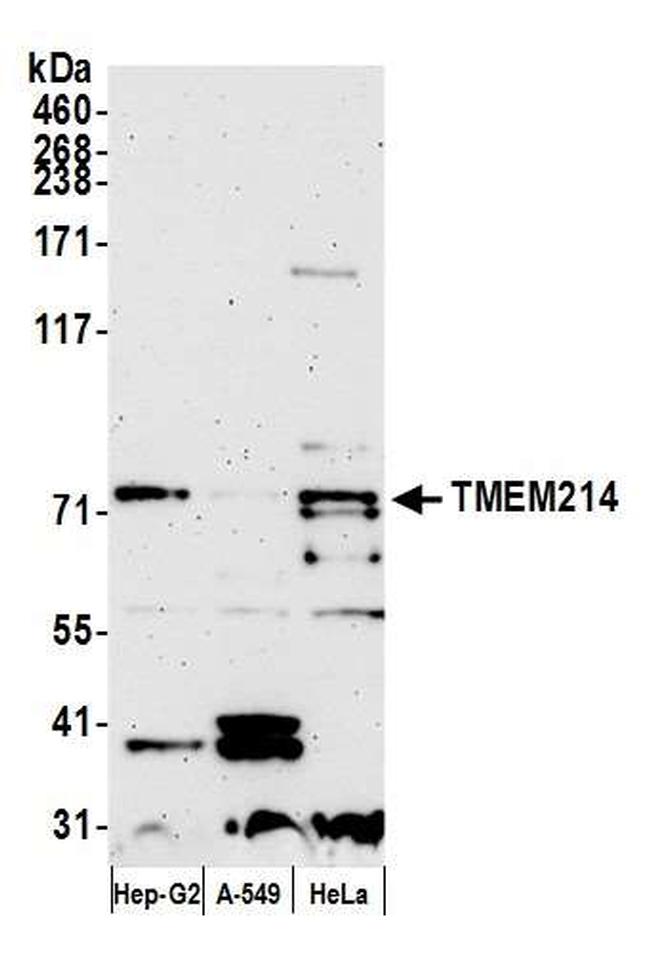 TMEM214 Antibody in Western Blot (WB)