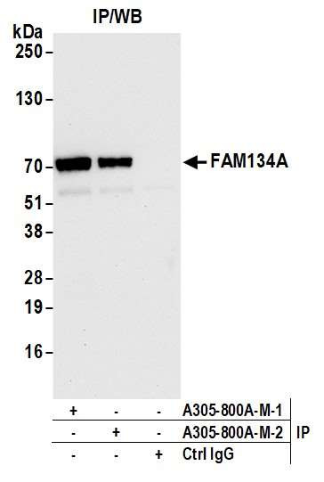 FAM134A Antibody in Immunoprecipitation (IP)