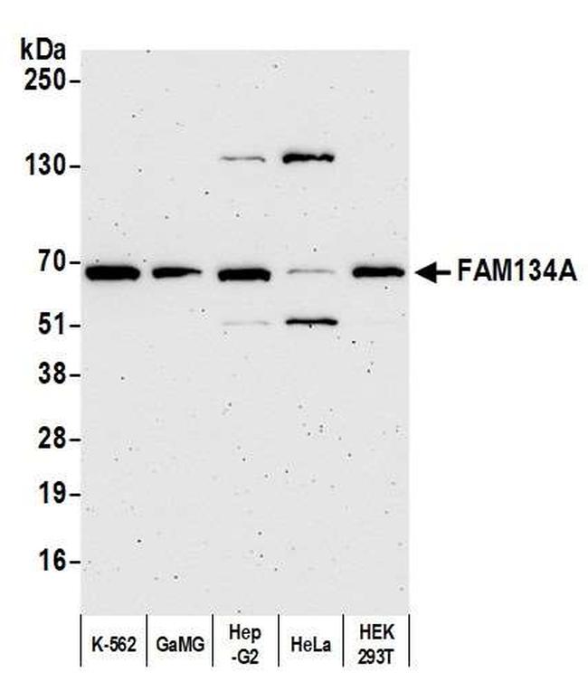 FAM134A Antibody in Western Blot (WB)