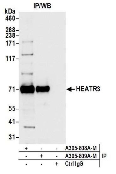 HEATR3 Antibody in Immunoprecipitation (IP)