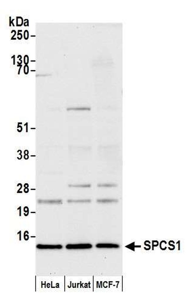 SPCS1 Antibody in Western Blot (WB)