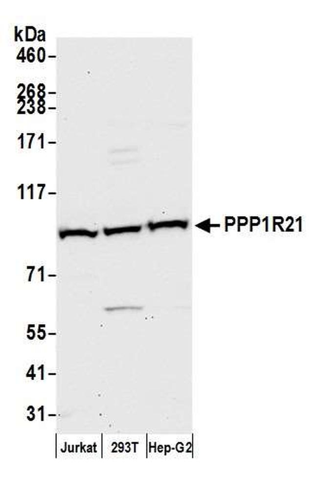PPP1R21 Antibody in Western Blot (WB)