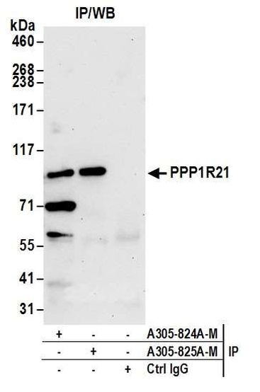 PPP1R21 Antibody in Immunoprecipitation (IP)