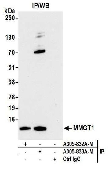 MMGT1 Antibody in Immunoprecipitation (IP)