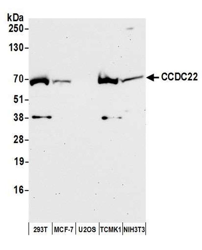 CCDC22 Antibody in Western Blot (WB)