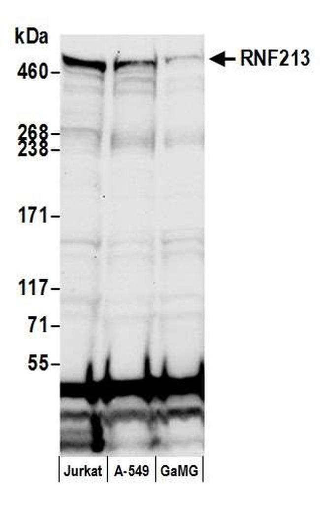 RNF213 Antibody in Western Blot (WB)