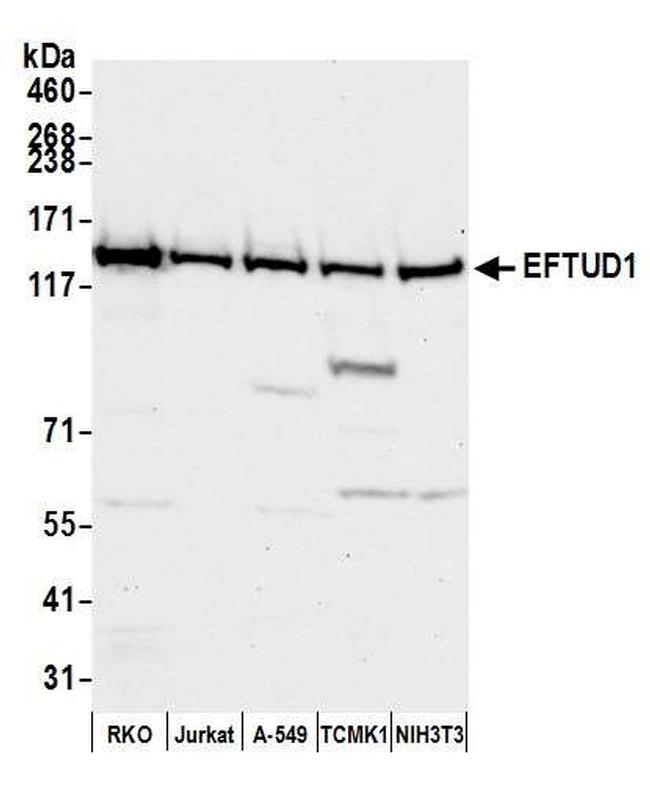 EFTUD1 Antibody in Western Blot (WB)