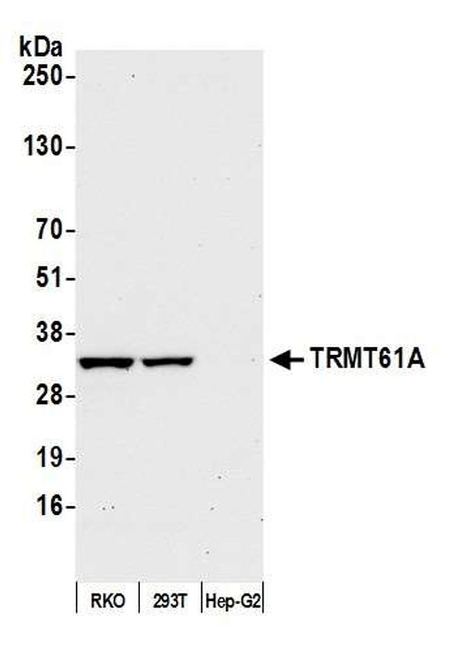 TRMT61A Antibody in Western Blot (WB)