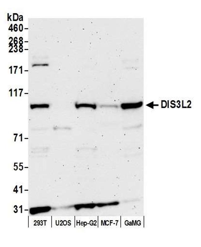 DIS3L2 Antibody in Western Blot (WB)
