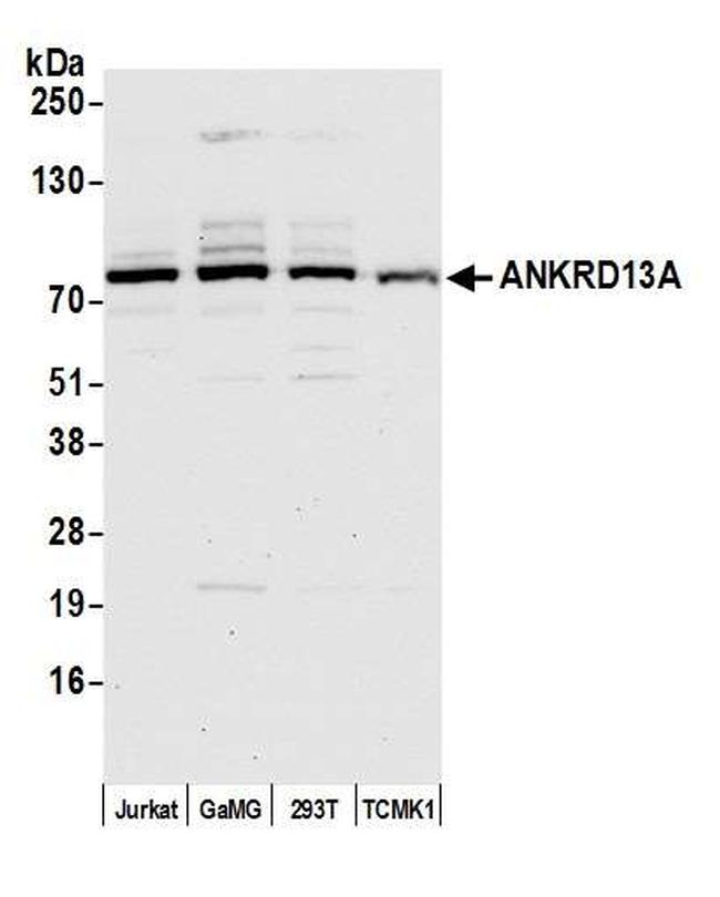 ANKRD13A Antibody in Western Blot (WB)