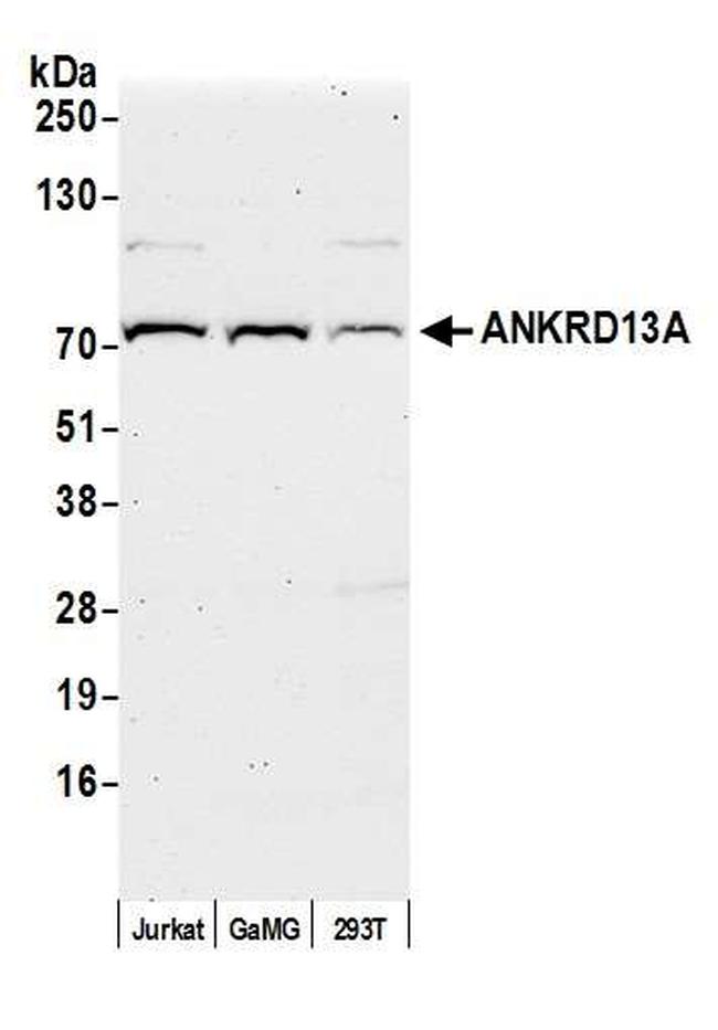 ANKRD13A Antibody in Western Blot (WB)