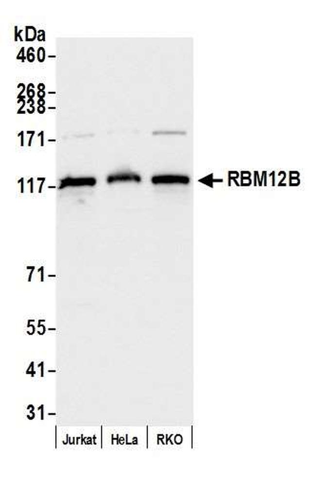 RBM12B Antibody in Western Blot (WB)