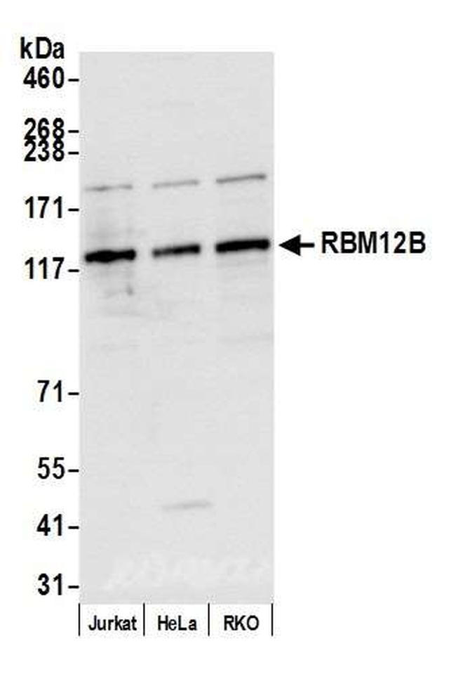 RBM12B Antibody in Western Blot (WB)
