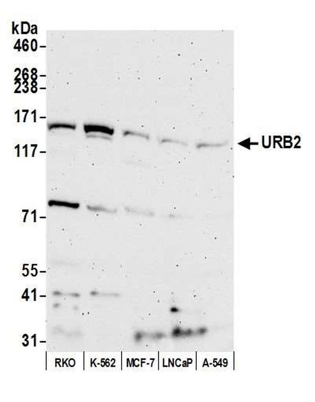 URB2 Antibody in Western Blot (WB)