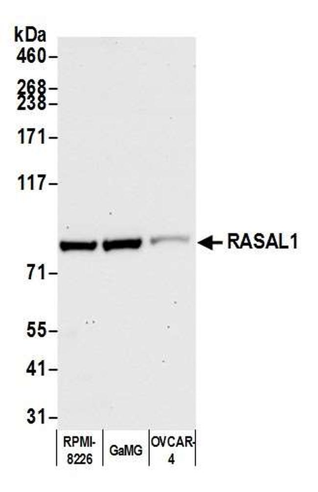 RASAL1 Antibody in Western Blot (WB)