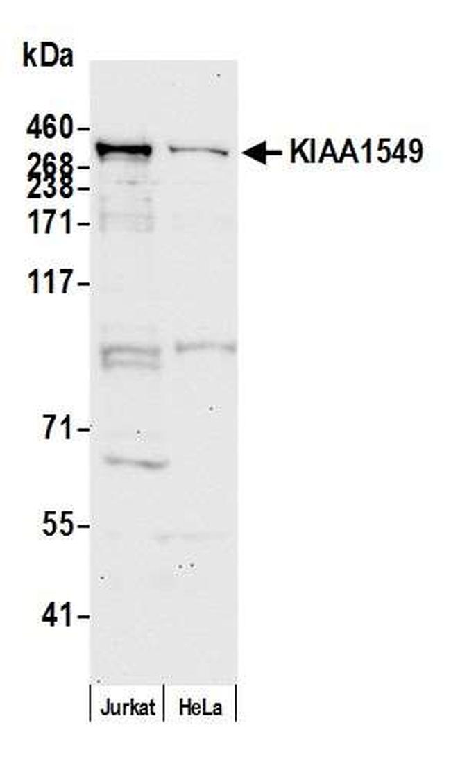 KIAA1549 Antibody in Western Blot (WB)