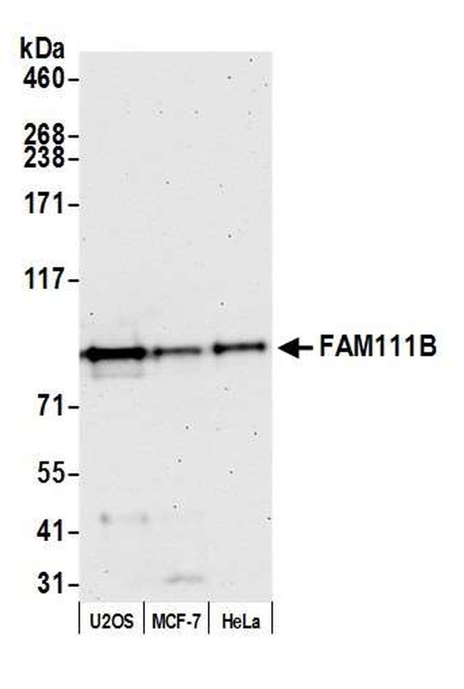 FAM111B Antibody in Western Blot (WB)