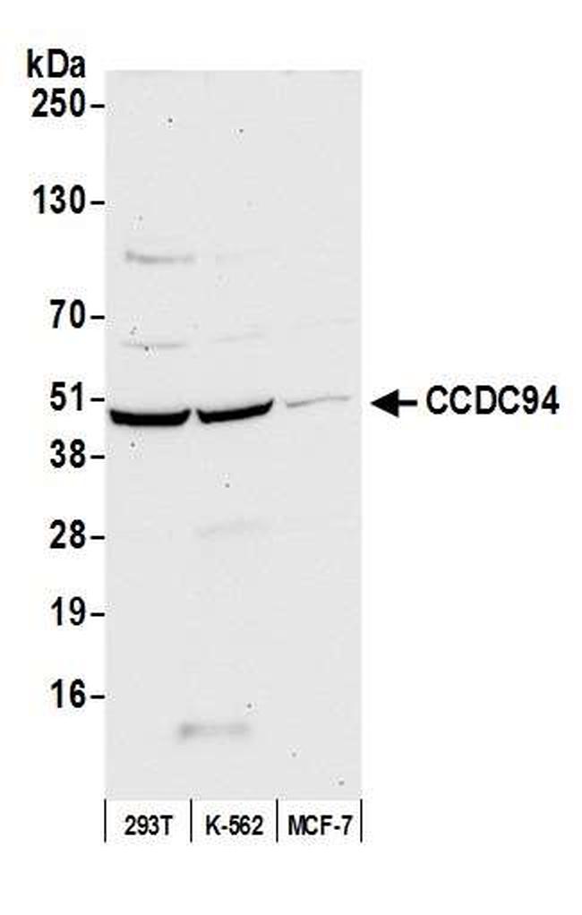 CCDC94 Antibody in Western Blot (WB)