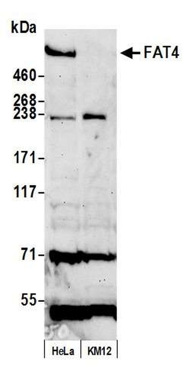 FAT4 Antibody in Western Blot (WB)