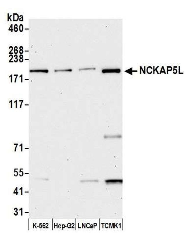 NCKAP5L Antibody in Western Blot (WB)