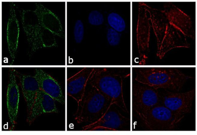 Mouse IgG (H+L) Secondary Antibody in Immunocytochemistry (ICC/IF)